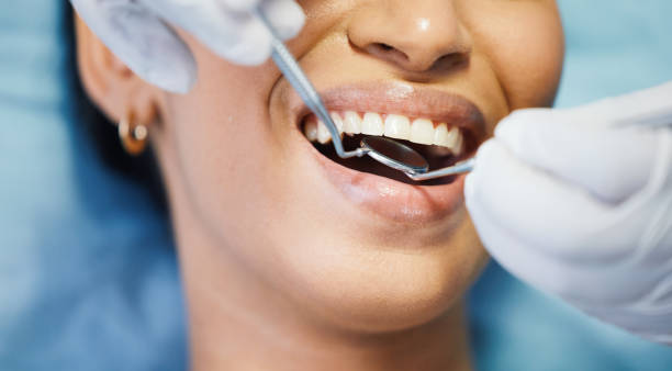 Best Emergency Dental Extractions in Pikesville, MD